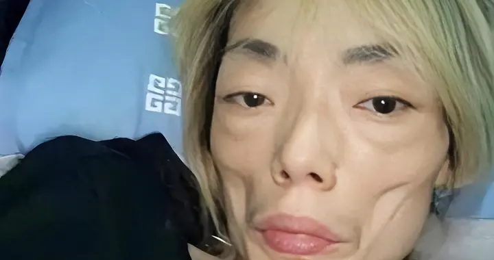 一代女神沦为豪门玩物：结婚8年牙齿全掉，器官切除，面似骷髅