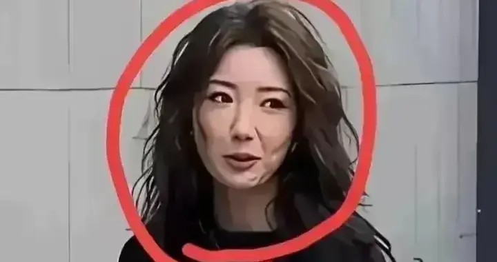 37岁毛晓彤医美后遗症曝光，昔日女神容颜不再，肿胀面容好尴尬