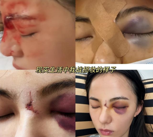 知名演员突发意外！工作人员失误致从高空摔下，表情吃痛一片狼藉