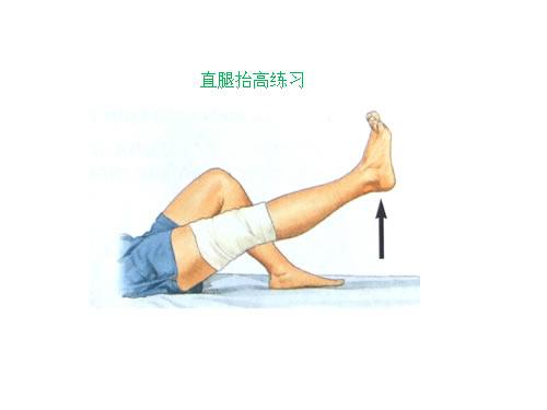 股四头肌功能锻炼方法图片