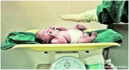 产房内你不知道的事, 原来宝宝出生后的五分钟医生都在忙这些事
