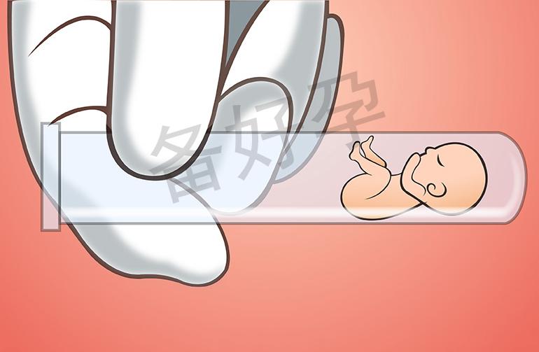 q6q5F_试管婴儿胚胎移植以后需要注意些什么