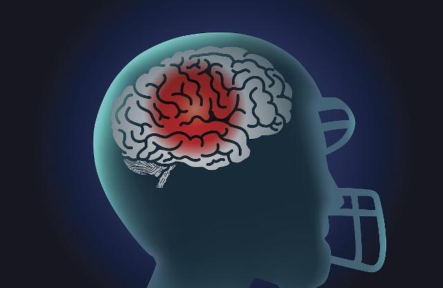 运动|脑梗的“真凶”终于找到了，或许是这3个，尤其是最后一个！