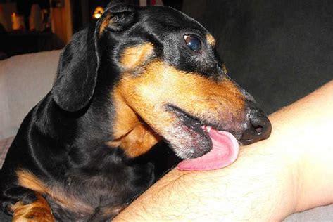 享受狗狗舔你脸? 小心把命搭进去!