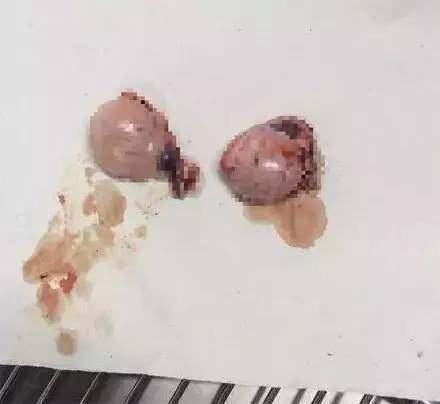 二哈做了绝育手术后以为会找主人干架, 不料差点得了抑郁症