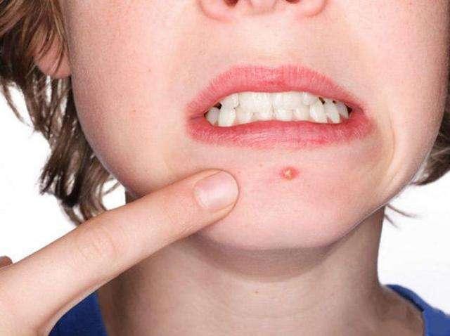 要脸部皮肤状态好? 这4点一定不能有