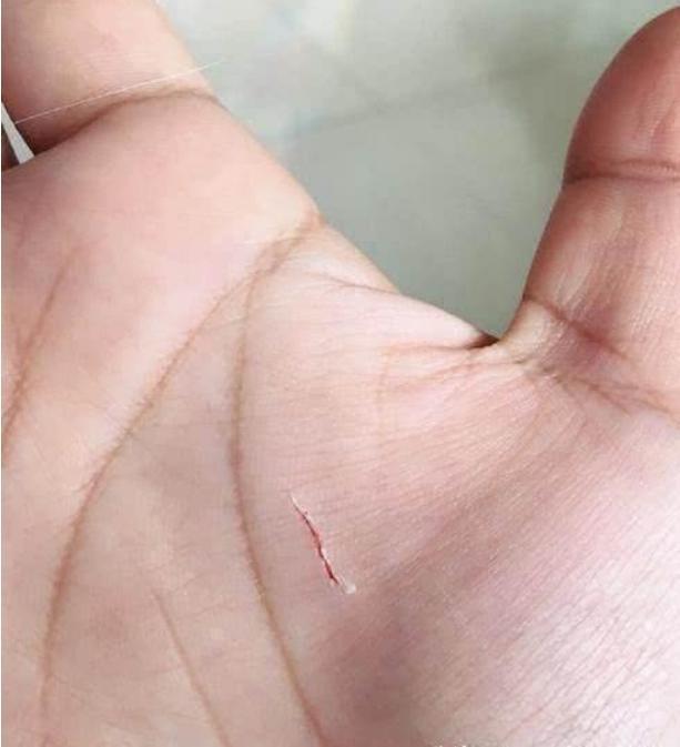 小伙到女友家做客, 摸了一把宠物猫咪的小脸, 手伤了对象也吹了!