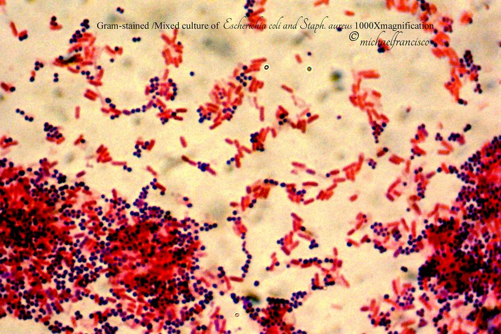 大肠杆菌革兰图片