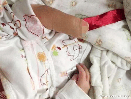 宝宝出生时才发现少一只手吓坏医生, 结果竟是孕妇这种恶习导致