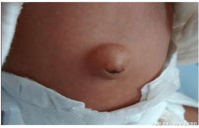宝宝身上的5大奇怪现象, 妈妈不懂这些真对不起宝宝