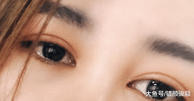 女人脸上这几个地方的痣是吉痣, 命相好的女人脸上就有这种痣