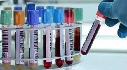 世界卫生组织出手, 到2030年消灭狗介质的狂犬病, 将惠及数万人