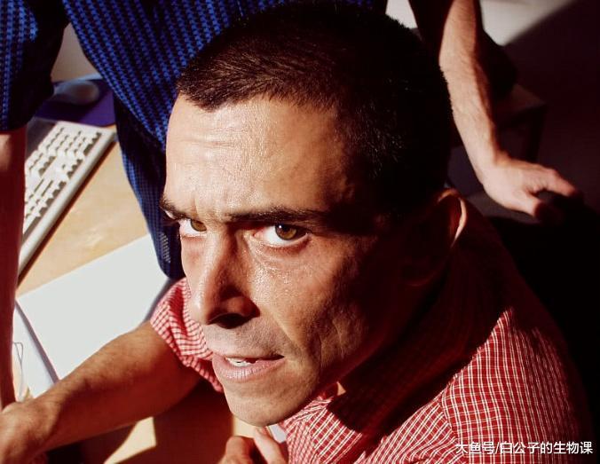 难以治愈的男性综合症会影响您的人际关系吗? 了解一下症状吧