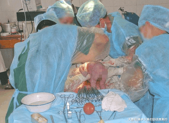 产房内你不知道的事, 原来宝宝出生后的五分钟医生都在忙这些事