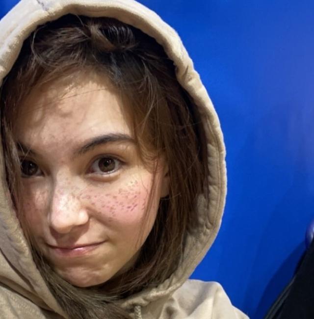 昆凌晒素颜自拍自信大方,罕见皮肤满脸雀斑,皮肤太白嫩了