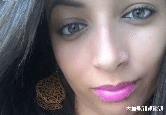 女子生来没有那个， 医生用鱼皮替其再造, 与男友成功完成“亲密行为”