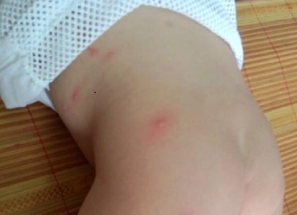 床上百万螨虫成窝？上海大妈只要一个小偏方，螨虫连根拔起！