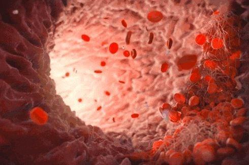 六味地黄丸▲每天都吃六味地黄丸，到最后会怎样？内科专家的答案出来了