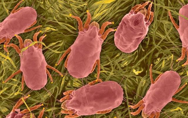 原来螨虫真 的很 怕这个，床上放一些，直接连窝端，螨虫一只不留