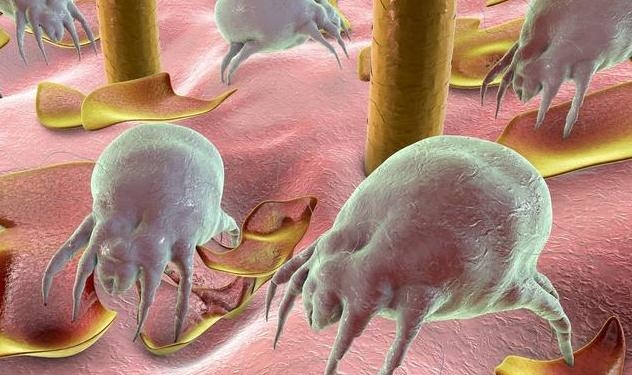 感觉家里螨虫超级多？婆婆教你解决办法，让螨虫不再陪你睡！