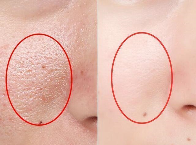 中国有种“尴尬”药膏, 穷人嫌它贵, 富人看不上, 老外却拿它当宝