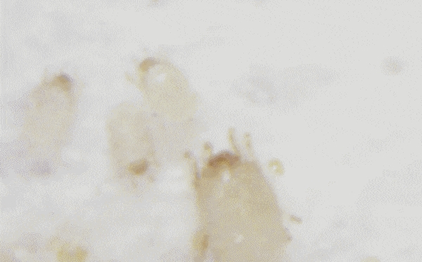 立秋后，家中螨虫繁殖增长，专家说道：卧室放一晚，螨虫连根拔除