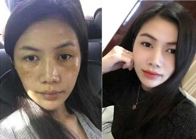 阿司匹林加它，成了最强“祛斑药”，每天抹几下，斑点哗哗往下掉