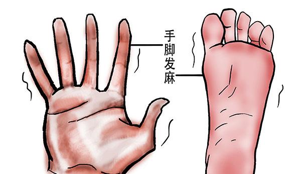 经常手脚发麻是什么原因导致的？原因很常见，也许你没有想到