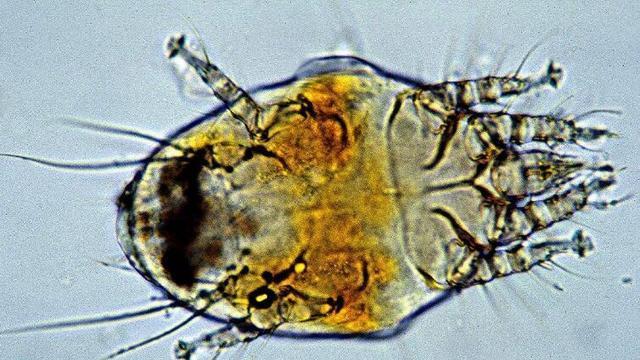 背上螨虫成堆？广东保洁阿姨教你一小招，螨虫一晚上就消失不见