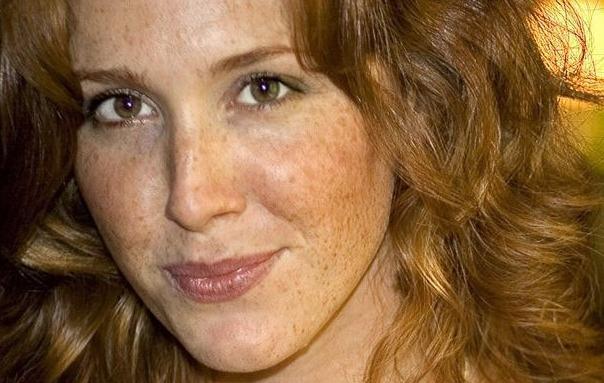 脸上突然冒出“老年斑”, 药店有一种医用乳膏, 5次斑点如雨落下