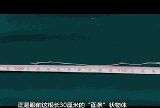 男子颅内惊现30厘米“面条”，全拜它所“赐”！