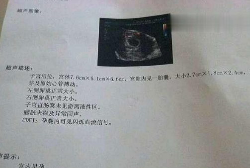 孕检时, B超单上这几样数据, 暗示怀女宝宝的概率很高!