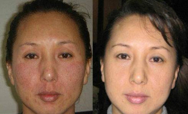 为什么你总是白不了？那是你没有掌握这6个窍门，亲测很有效哦！