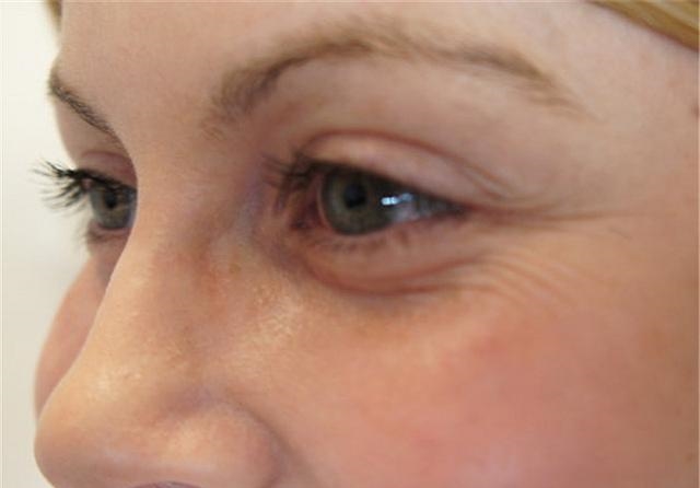 擦眼霜时做好这一步，能紧致肌肤不显老！