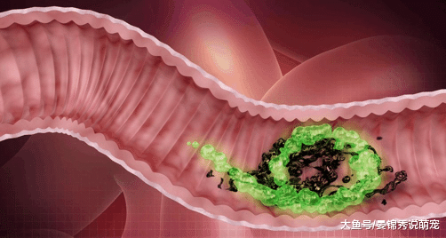 土豆号称“天然泻药”配它一起吃，排出臭宿便 ! 体重悄悄降下去