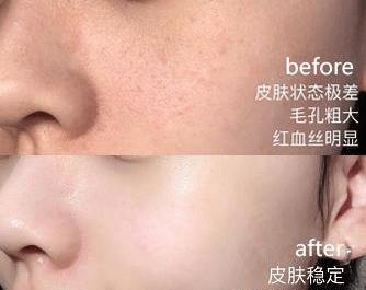 张馨予晒出用了3年的面霜,袁咏仪:我用了8年,李佳琦:堪称平价香奈儿!