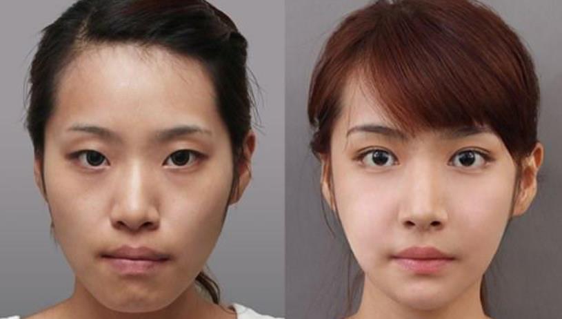 药店最火的“变态”发明，3次眼袋细纹全没了，半个娱乐圈人手一支