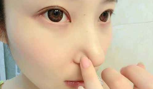 鼻子上的小疙瘩，挤出的白色物体是什么？北大医学博士说出“实情”