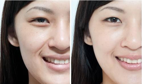 同济医院医生直言：厨房里不起眼的“它”，搽一搽，细纹眼袋自然抚平