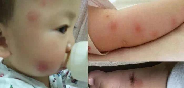 蚊子最害怕的东西，不是蚊香！莫不信，只需十分钟蚊子踪影全不见