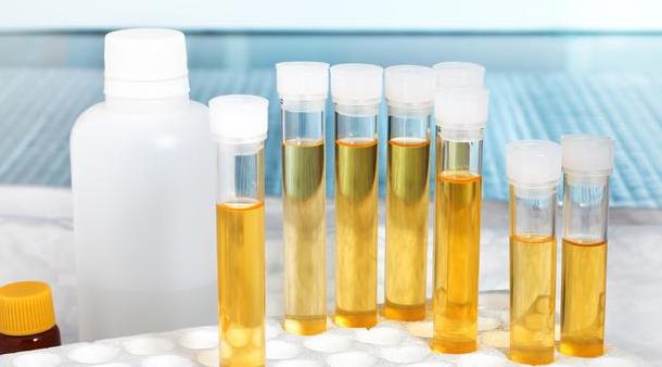 肝脏不好的人，上厕所会有4个“怪象”，很容易看出来