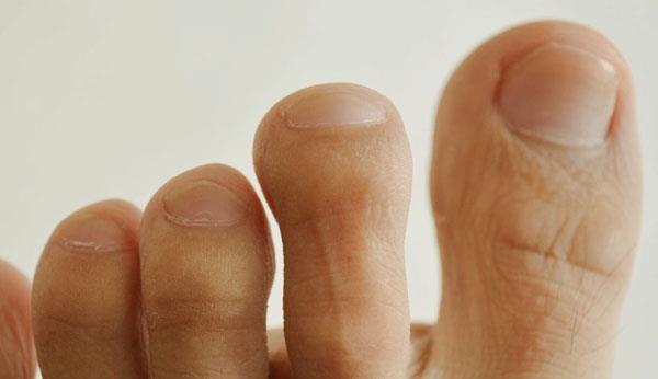 糖尿病人，双脚有这4种表现，或是血糖很高了！占一个也不是小事