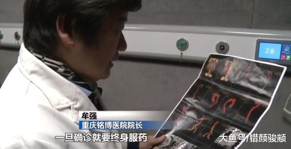 男子痛到瘫痪, 1个肾没了, 就因为他喝了这东西!
