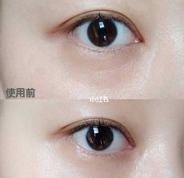 昨天吴昕晒出的怪物眼霜，网友：价格一查，从此扔阿玛尼