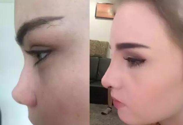 混血女被外网封, 上帝杰作, 整形过程全公开, 网友: 从头到脚没一处真