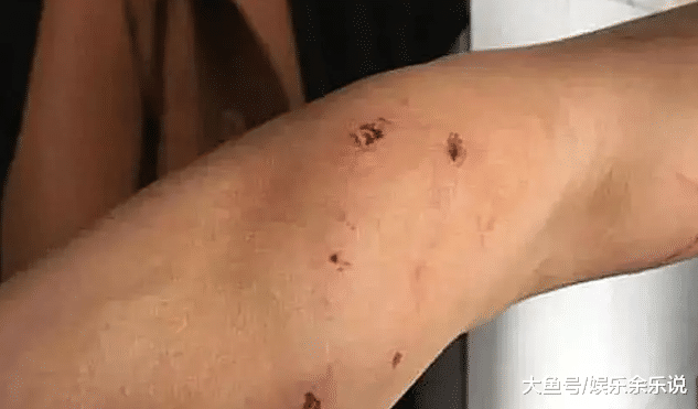 女子捡了一条流浪猫，收养几天后给它打疫苗，一针下去，后悔不已