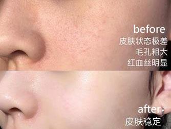 被称为“国宝级”的面霜，但因价格过低被看不起，袁咏仪：我用了8年