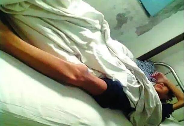八年前那位卖肾买iphone的高中生, 现在肾功能衰竭, 终日躺在病床上