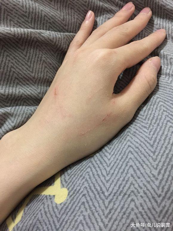 小貓不讓網友碰它，第一次碰它就被抓成這樣了，真厲害