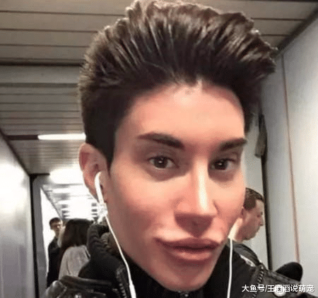 公认最丑的3种嘴巴，颜值“再高”也扛不住，基本“没人要”！